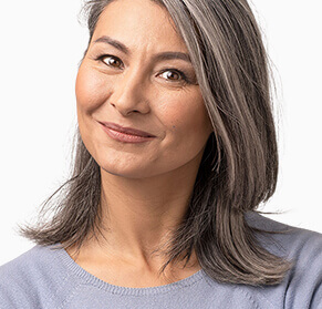 High SMAS facelift surgery model 01, Dr Richardson Melbourne